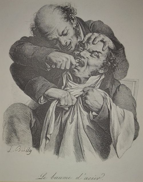 Litografia Louis Boilly z XIX w. przedstawiająca wyrywanie zęba